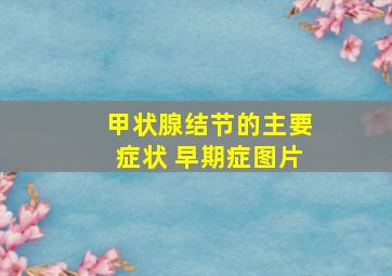 甲状腺结节的主要症状 早期症图片